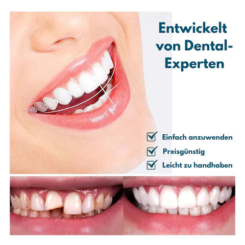 HappySmile™ Zahnspangen-Simulation Zahnersatz | 50% Rabatt