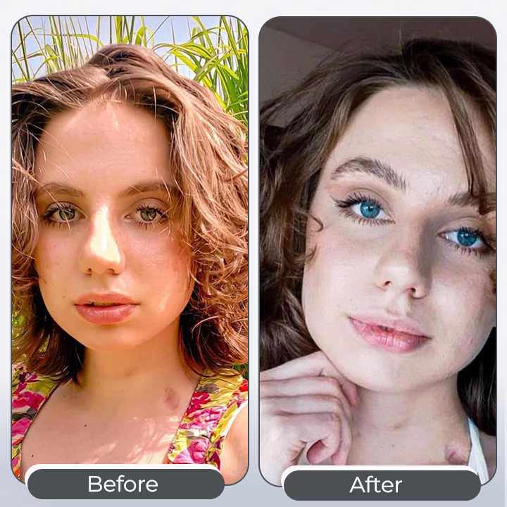 EyeCatcher™ – Augen-Tropfen für irisfarbenen Farbwechsel und strahlende Augen [1 + 1 Gratis]