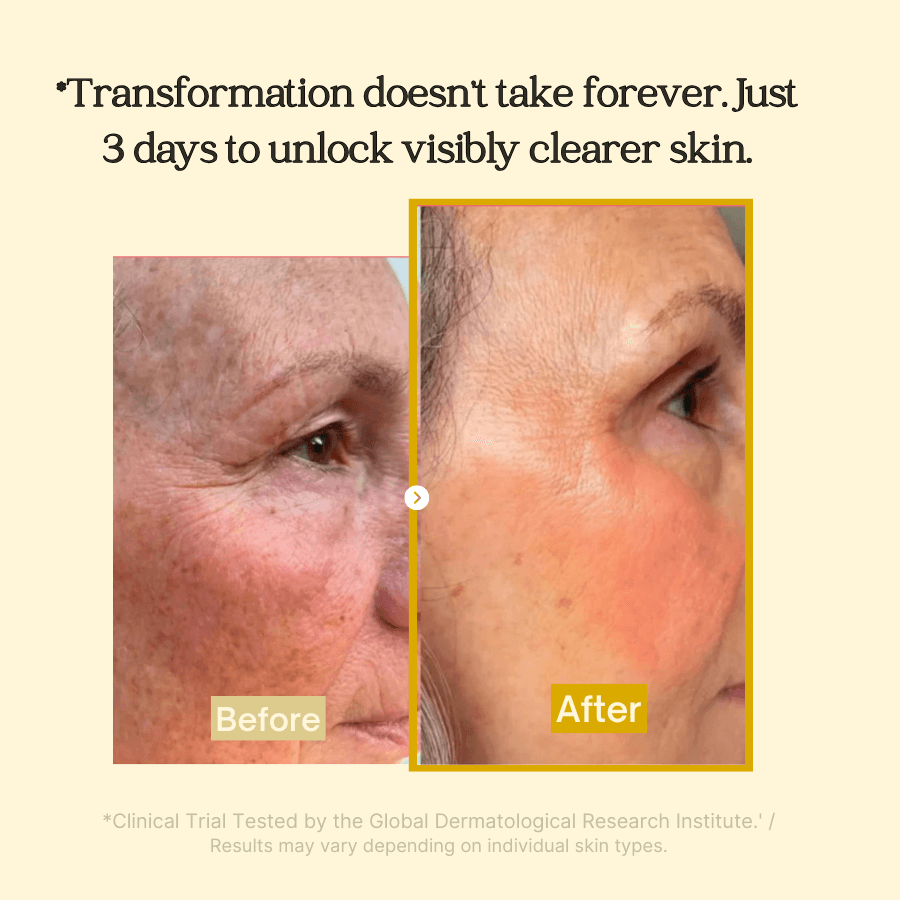 BrightMask™ – Übernacht-Peeling-Maske mit Kollagen, Kurkuma & Kojicsäure für strahlende Haut [50 % Rabatt]