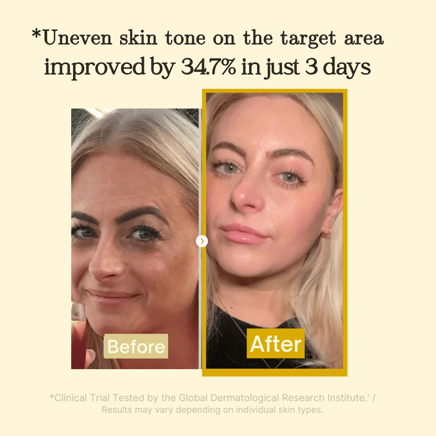 BrightMask™ – Übernacht-Peeling-Maske mit Kollagen, Kurkuma & Kojicsäure für strahlende Haut [50 % Rabatt]