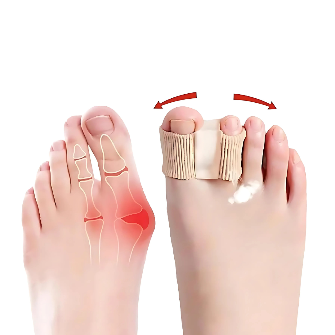 ToeSplit™ – Elastisches Nylon & SEBS für Schmerzlinderung & optimale Fußhaltung [1 + 1 Gratis]