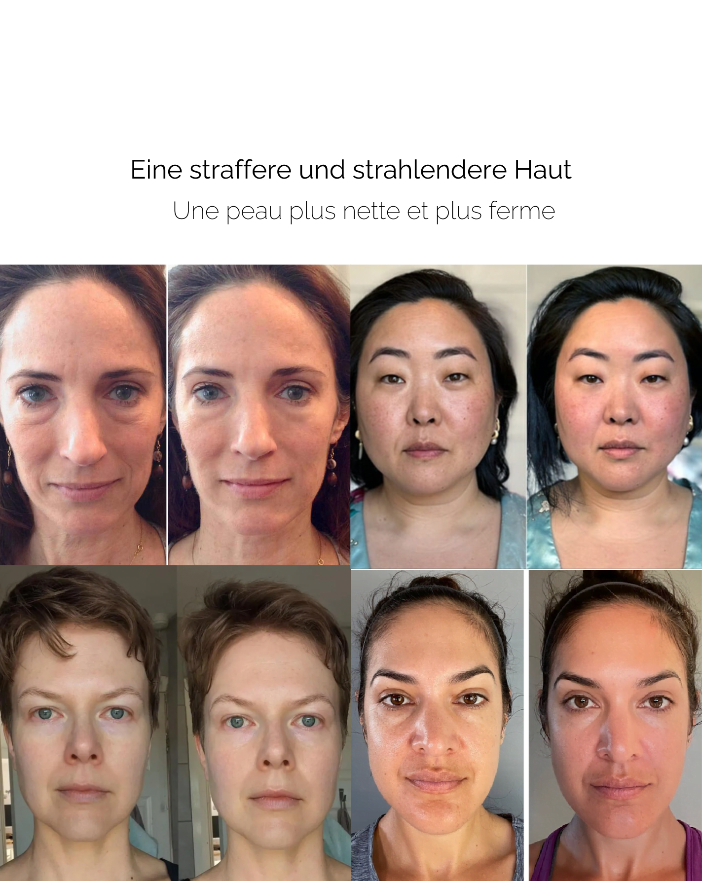 SkinRoll™ – Anti-Falten Schönheitstool für glatte, strahlende und jugendliche Haut [50 % Rabatt]