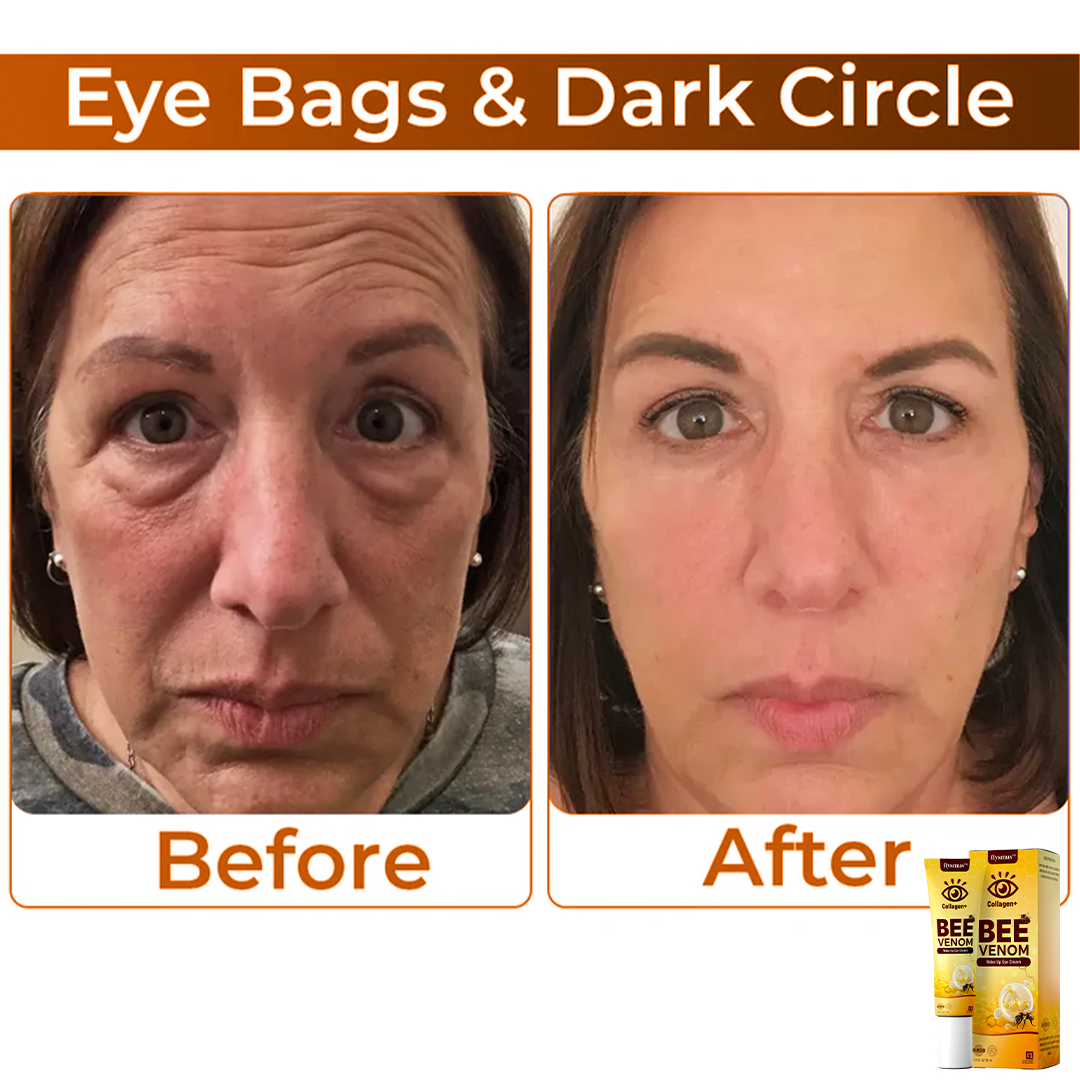 BeeVenom™ – Erwecke deinen Blick zu strahlender, jugendlicher Schönheit [1 + 1 Gratis]