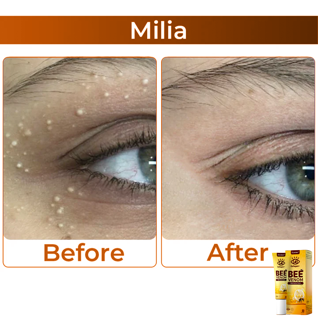 BeeVenom™ – Erwecke deinen Blick zu strahlender, jugendlicher Schönheit [1 + 1 Gratis]