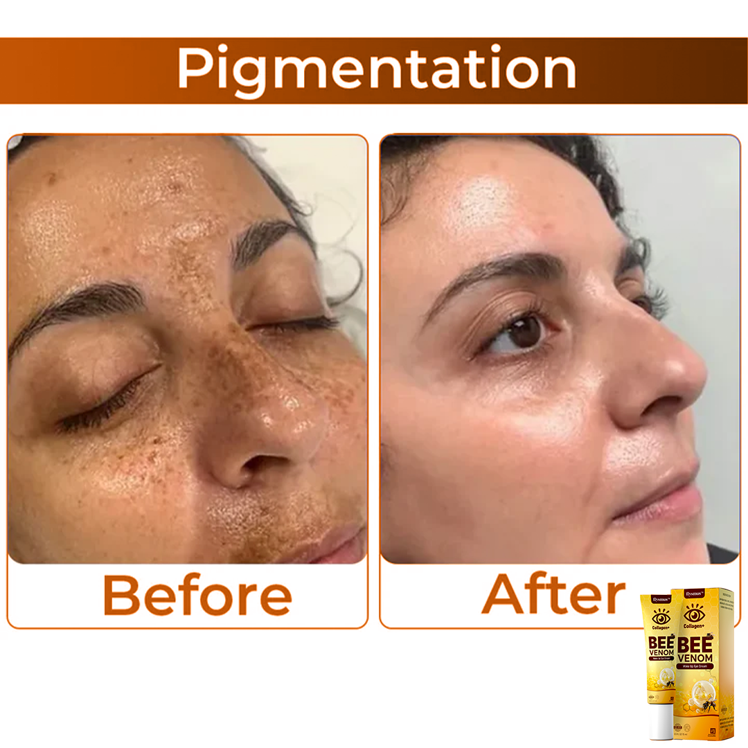 BeeVenom™ – Erwecke deinen Blick zu strahlender, jugendlicher Schönheit [1 + 1 Gratis]