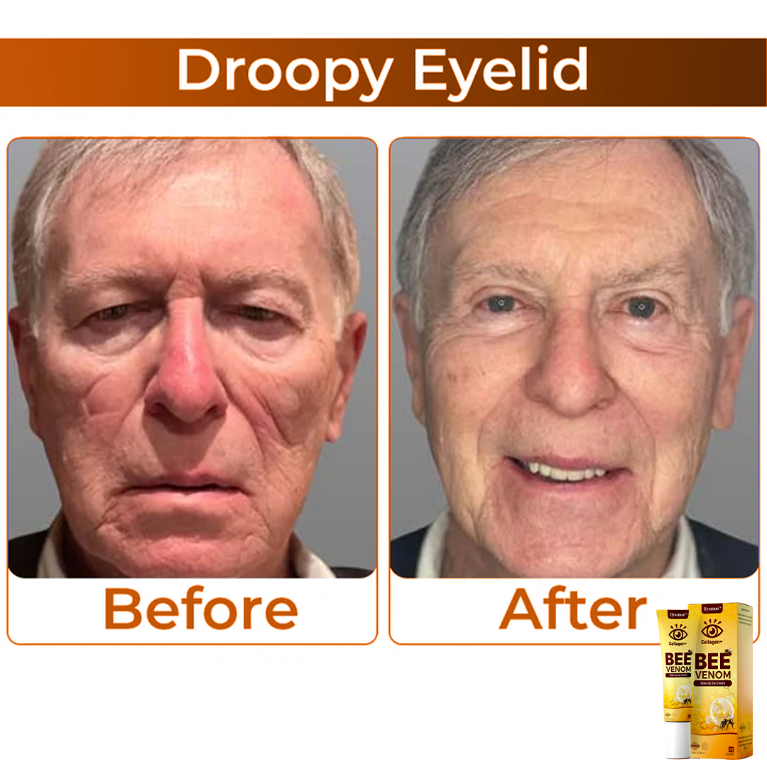 BeeVenom™ – Erwecke deinen Blick zu strahlender, jugendlicher Schönheit [1 + 1 Gratis]