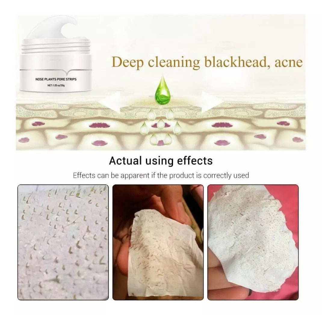 ClearSkin Porenstrips – Mitesser, Aktivkohle, Reinigung, Aloe Vera, Hautpflege, Klarer Teint