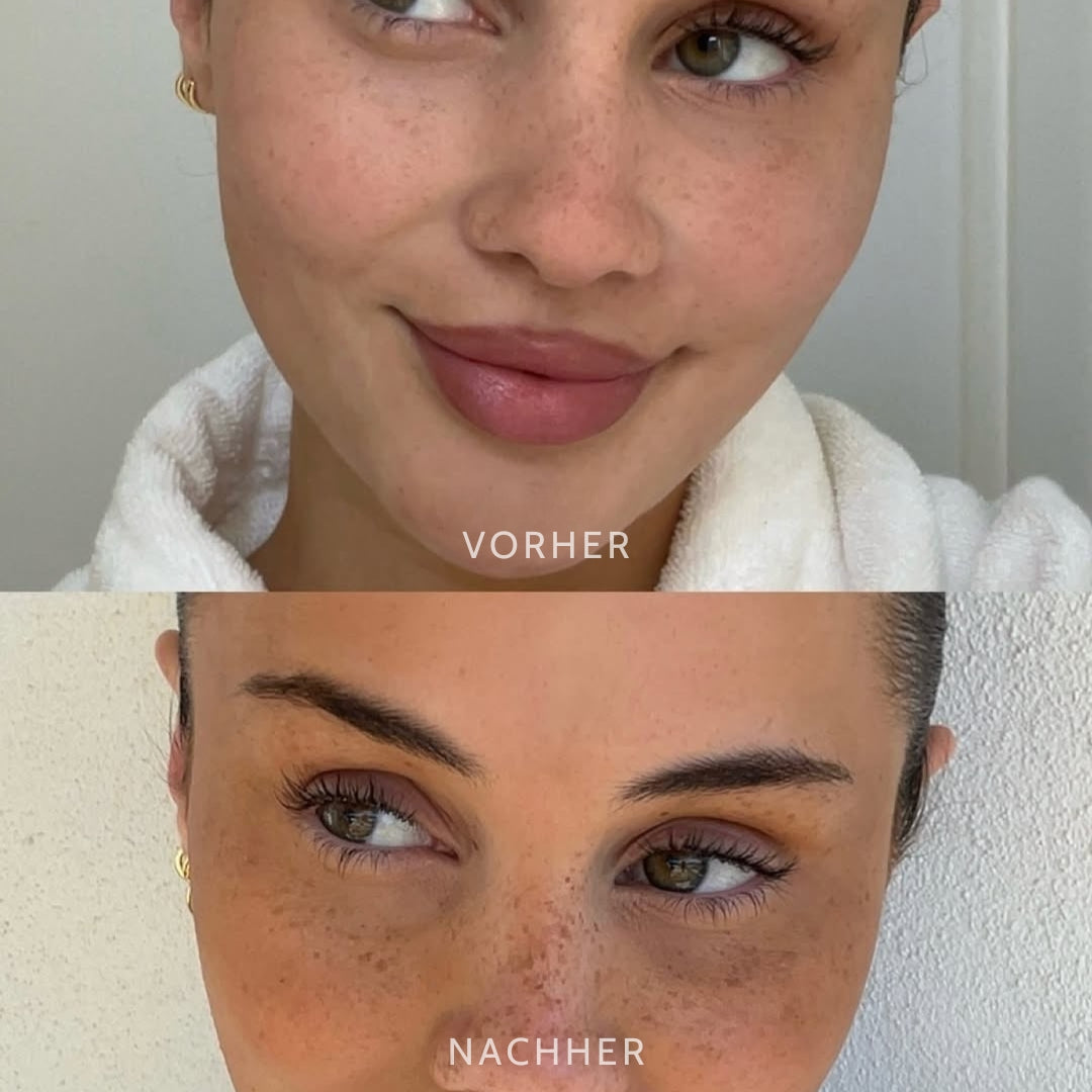SpeckleTouch™ – Verspielter & auffälliger Beauty-Akzent [50 % Rabatt]