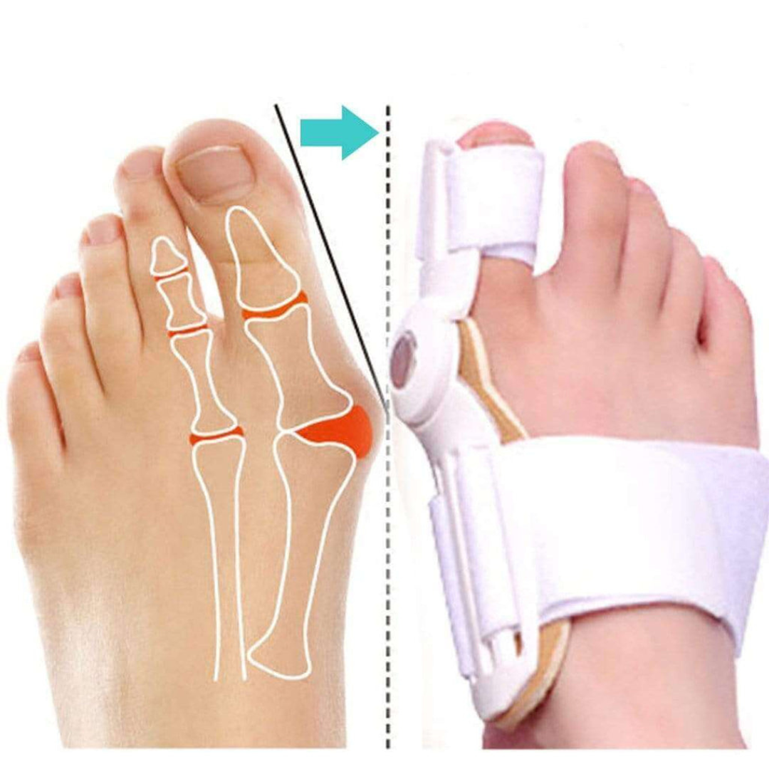 1 + 1 Gratis | ToeSupport™ - Bequemes Ausrichten der Zehen