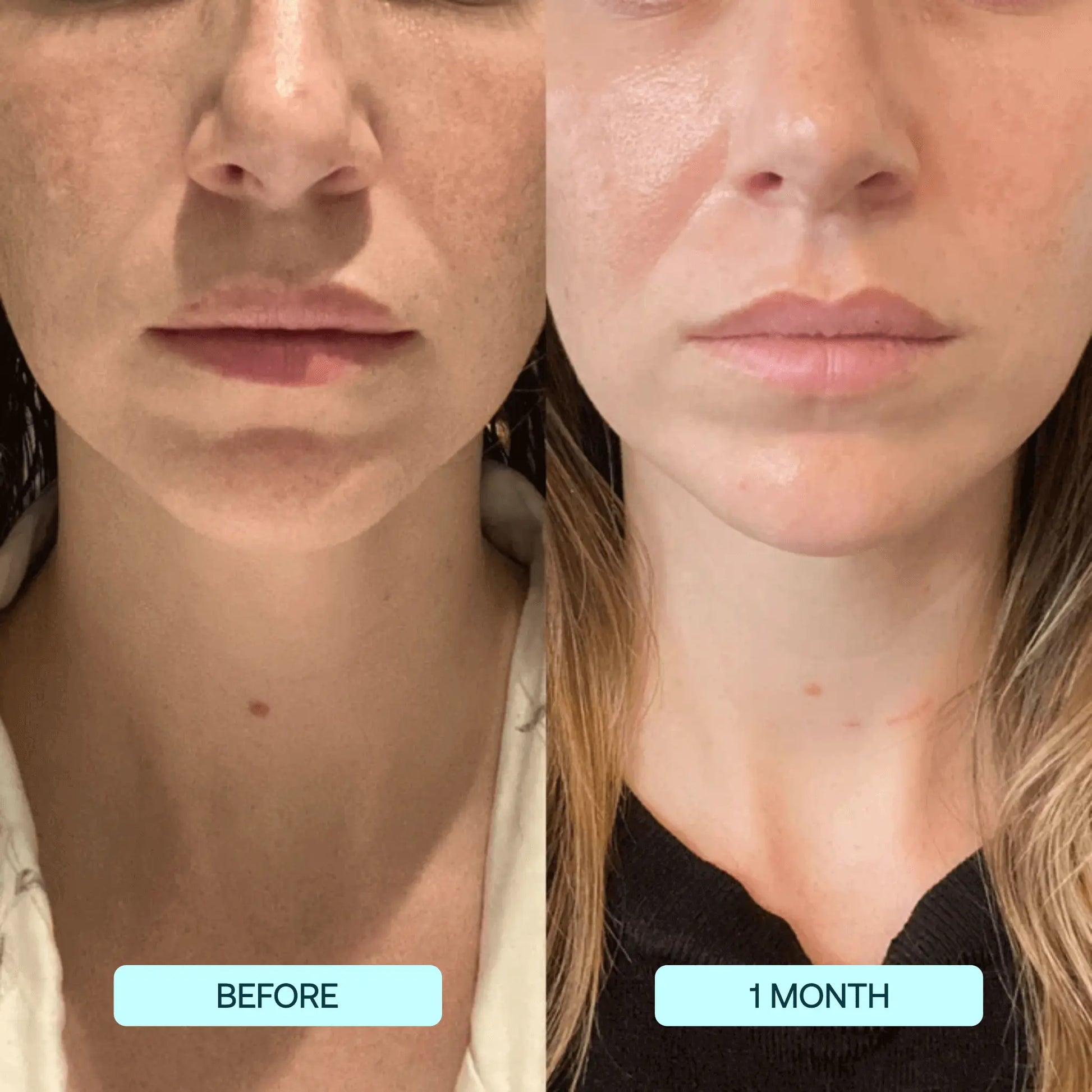 GlowSkin™ - Sofort glattere Haut [1 + 1 Gratis]