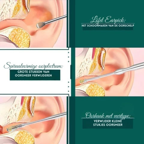 DermaCare Ohrenschmalz Entferner Set – 6-in-1 Edelstahl Ohrreiniger für Sanfte & Sichere Ohrpflege