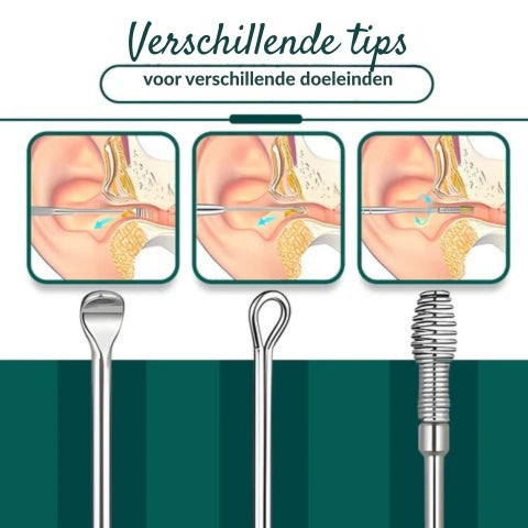 DermaCare Ohrenschmalz Entferner Set – 6-in-1 Edelstahl Ohrreiniger für Sanfte & Sichere Ohrpflege
