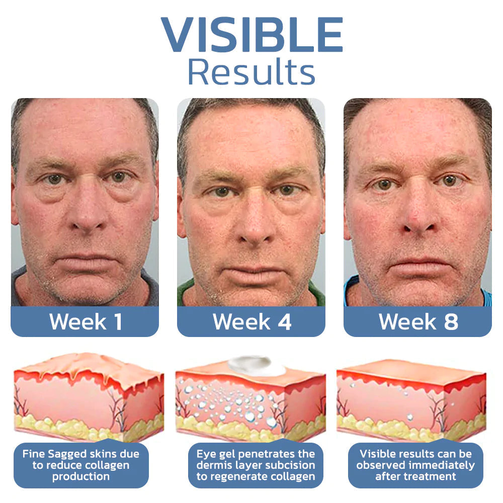 1 + 1 Gratis | OpenEyes™ - Verjüngendes Augen-Lifting-Gel für Männer und Frauen