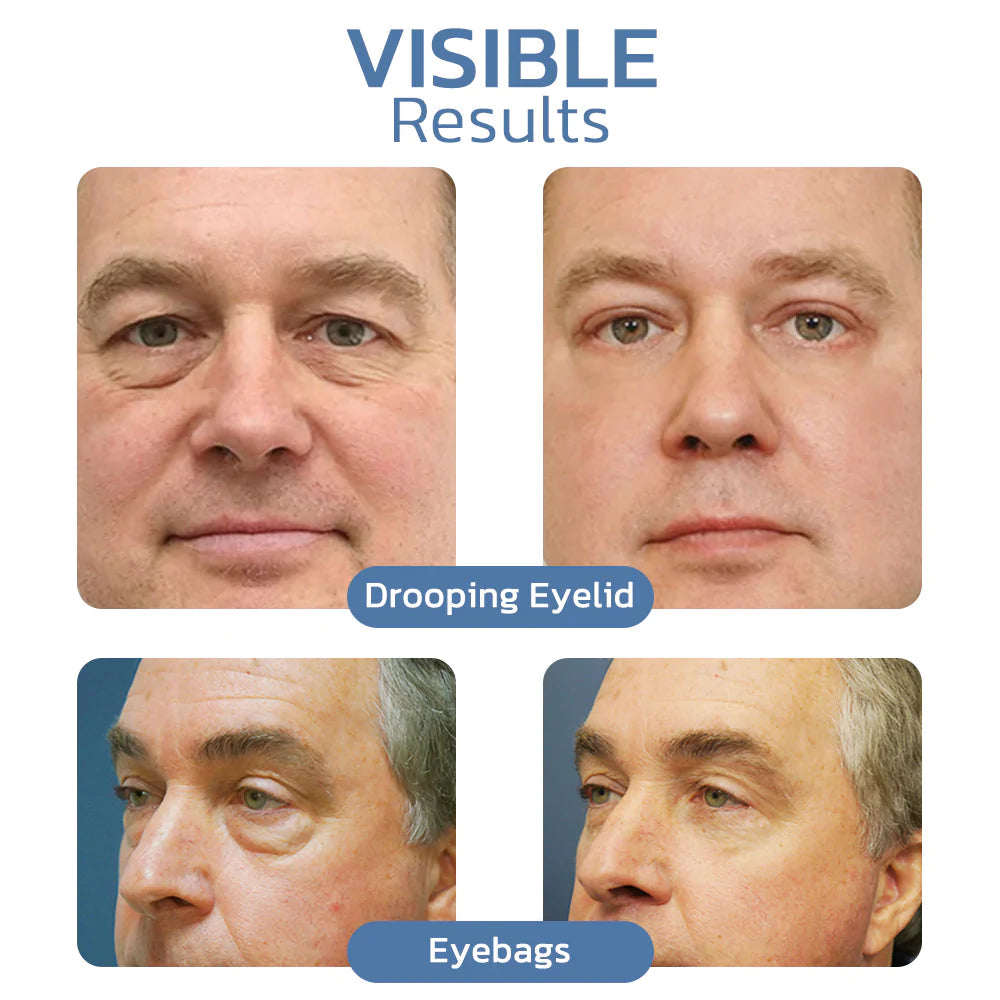 1 + 1 Gratis | OpenEyes™ - Verjüngendes Augen-Lifting-Gel für Männer und Frauen
