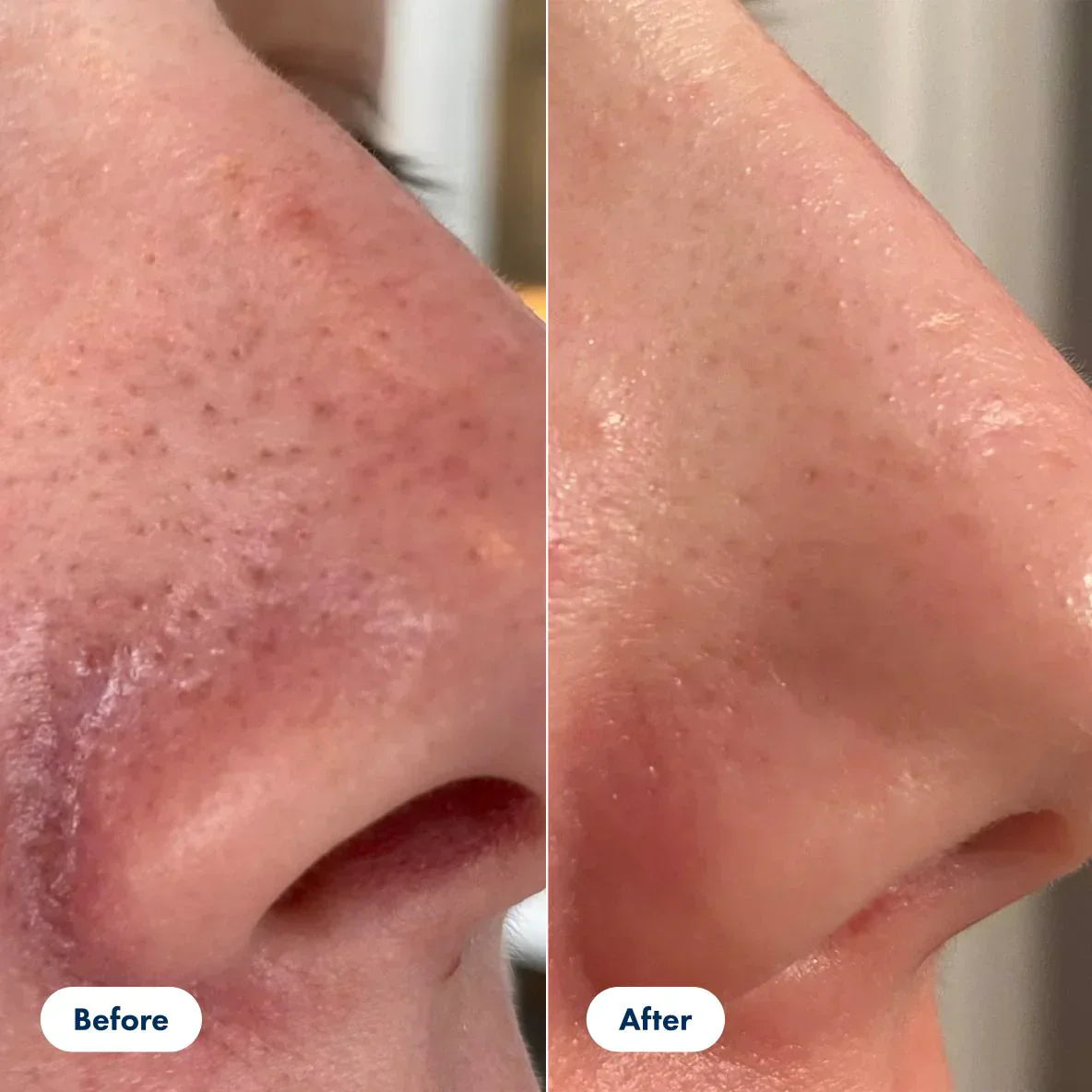 Gesichtspeeling™ – Sanfte Reinigung ohne Reizungen, entfernt Ablagerungen sofort effektiv [50% Rabatt]