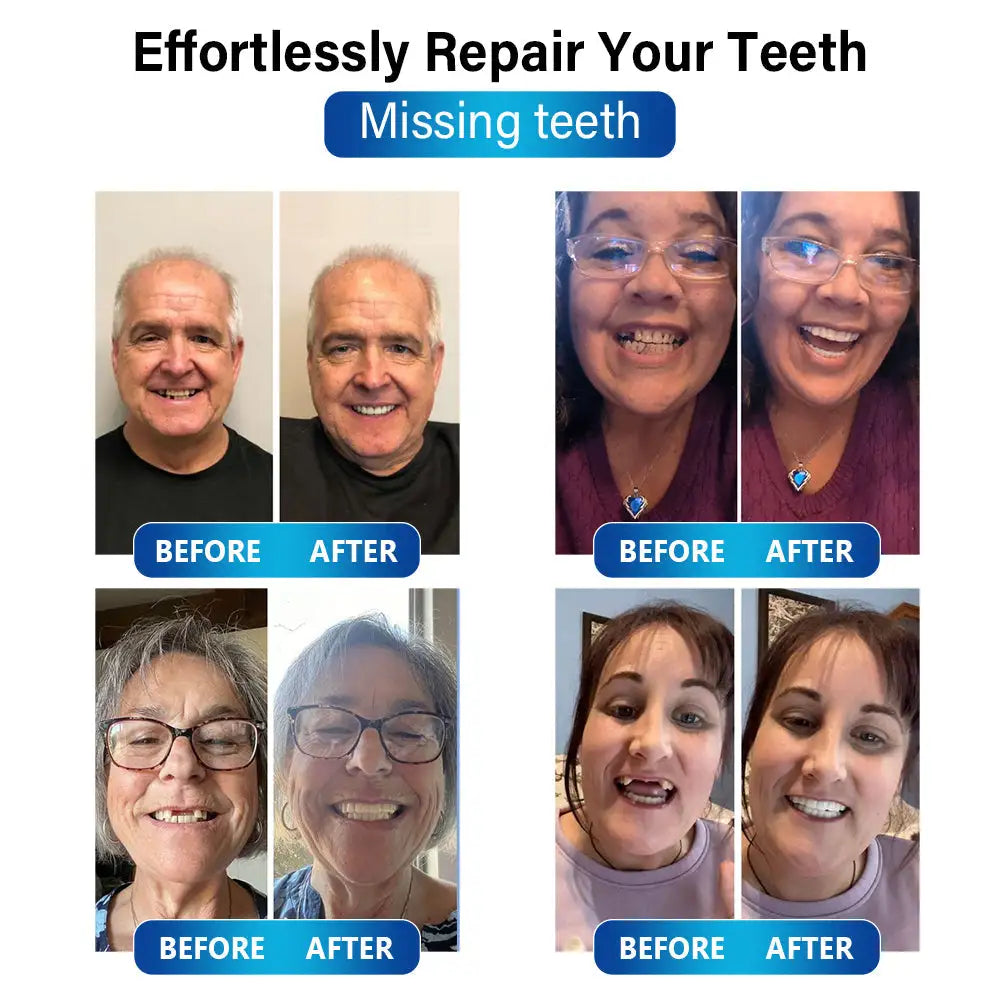 Futusly™ – Professionelle Blaulicht-Härtelampe und langlebige Prothesenmaterialien [50 % Rabatt]