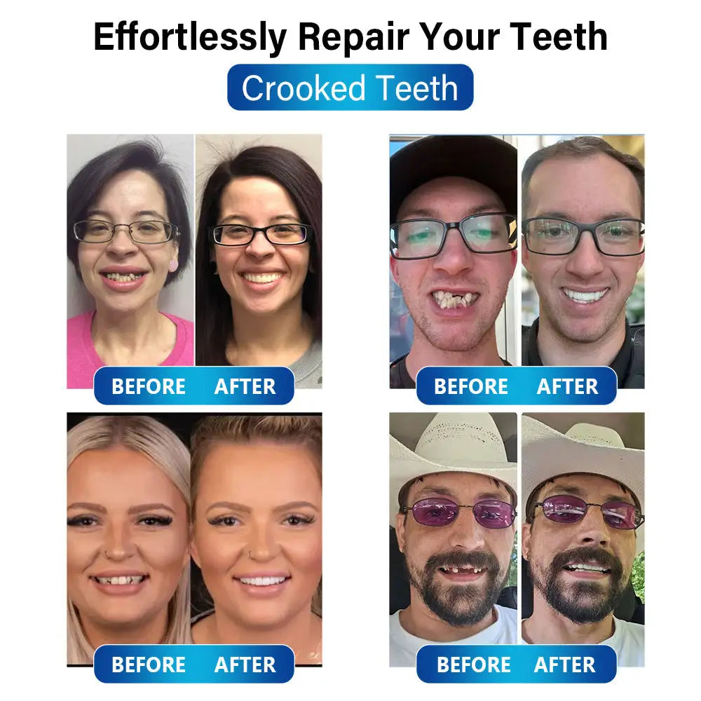 Futusly™ – Professionelle Blaulicht-Härtelampe mit langlebigen Prothesenmaterialien [50% Rabatt]