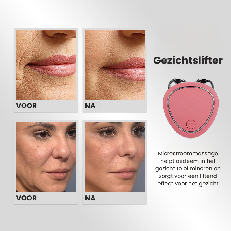 SkinVivo™ -Gesichtsmassagegerät [50% Rabatt]