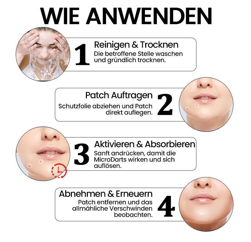 1 + 1 Gratis | DermiTag™ - Pro MicroDarts TAG'Gone Hautpflaster zur Skin-Tag-Entfernung