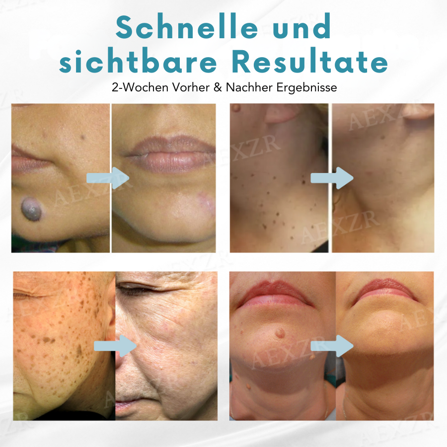Radiant™ – Schnelle, effektive, sanfte, natürliche und sichtbare Hautverjüngung [1 + 1 Gratis]