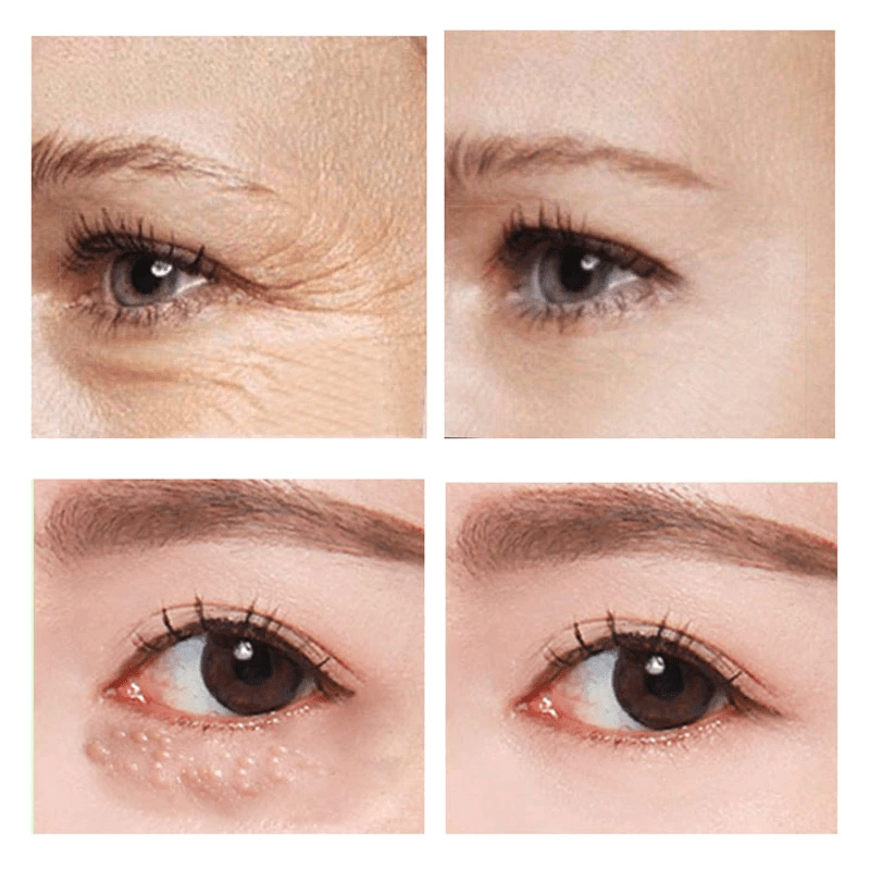 1 + 1 Gratis | EyeGlow™ - Sofort straffende Augencreme