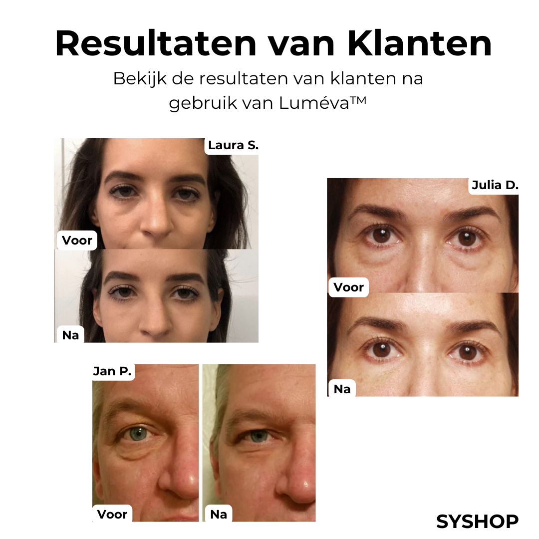 Lumeva™ – Augenstraffende Creme für glatte, jugendliche und strahlende Haut [1 + 1 Gratis]