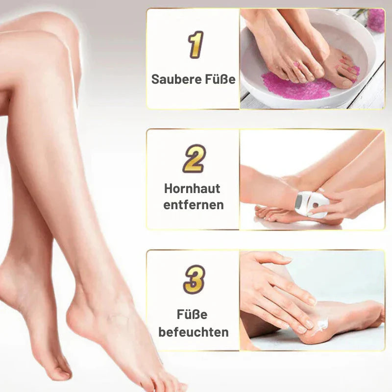 PediCare™ – Elektrischer Hornhautentferner für glatte Füße | 50% Rabatt