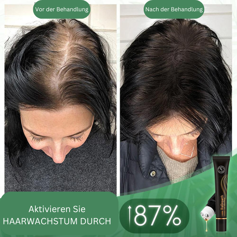 Regrowth™ – Bio-Haar-Serum-Roller für gesundes, kräftiges und glänzendes Haar [1 + 1 Gratis]