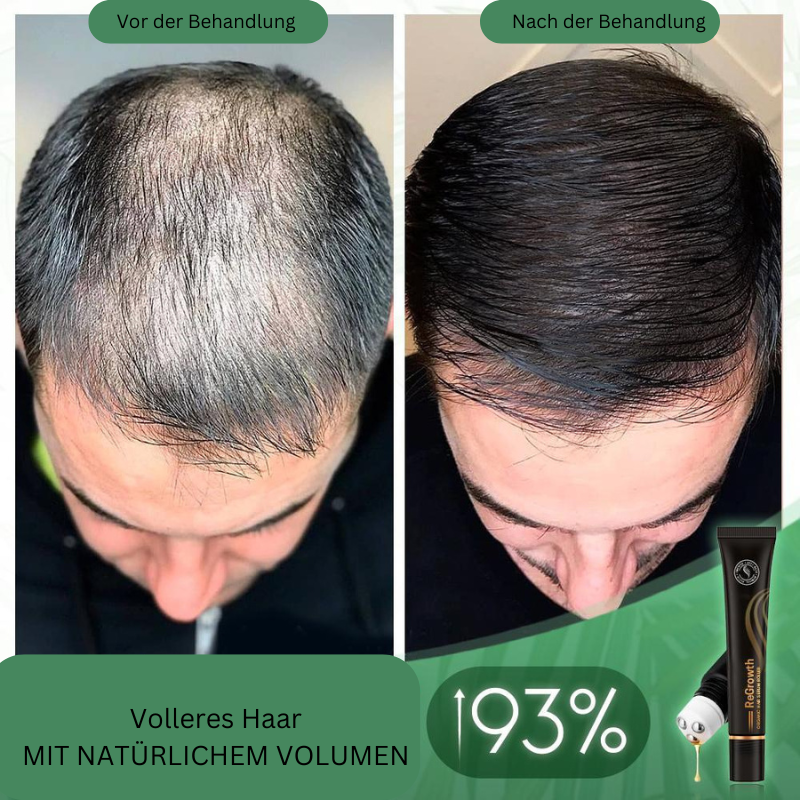 Regrowth™ – Bio-Haar-Serum-Roller für gesundes, kräftiges und glänzendes Haar [1 + 1 Gratis]