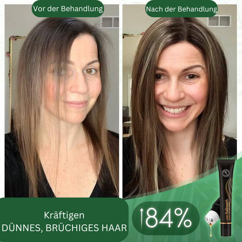 Regrowth™ – Bio-Haar-Serum-Roller für gesundes, kräftiges und glänzendes Haar [1 + 1 Gratis]