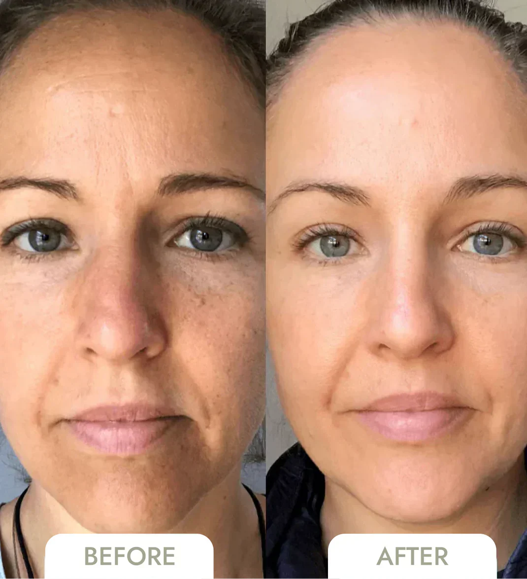 GlowSkin™ - Sofort glattere Haut [1 + 1 Gratis]