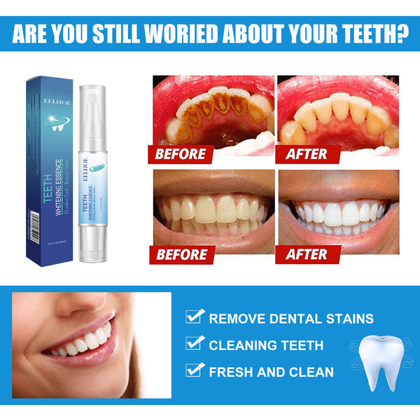 LächelBlitz Zahnaufhellung – Sanfte Teeth Whitening Essenz für Weiße & Gesunde Zähne