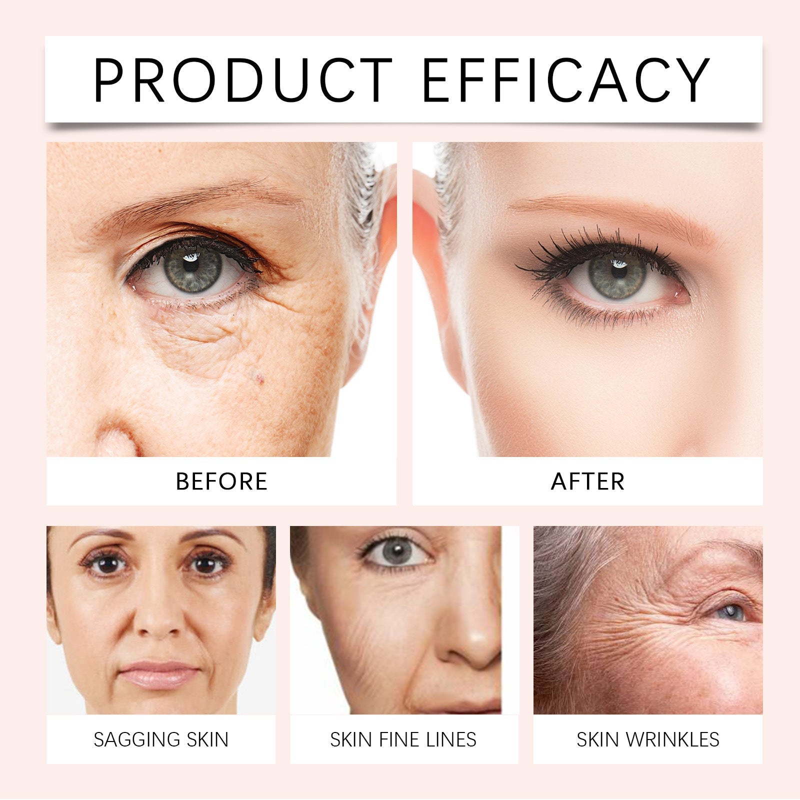 Jorondy™ – Sofort glättender Faltenfüller mit Vitamin C & Hagebuttenöl für straffe, strahlende Haut [50% Rabatt]