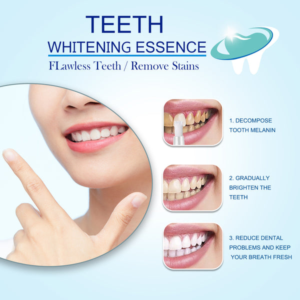 LächelBlitz Zahnaufhellung – Sanfte Teeth Whitening Essenz für Weiße & Gesunde Zähne