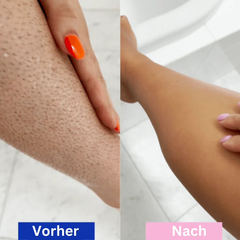 SilkGlow™ – Schmerzfreier Laser-Enthaarer für samtweiche Haut [50 % Rabatt]