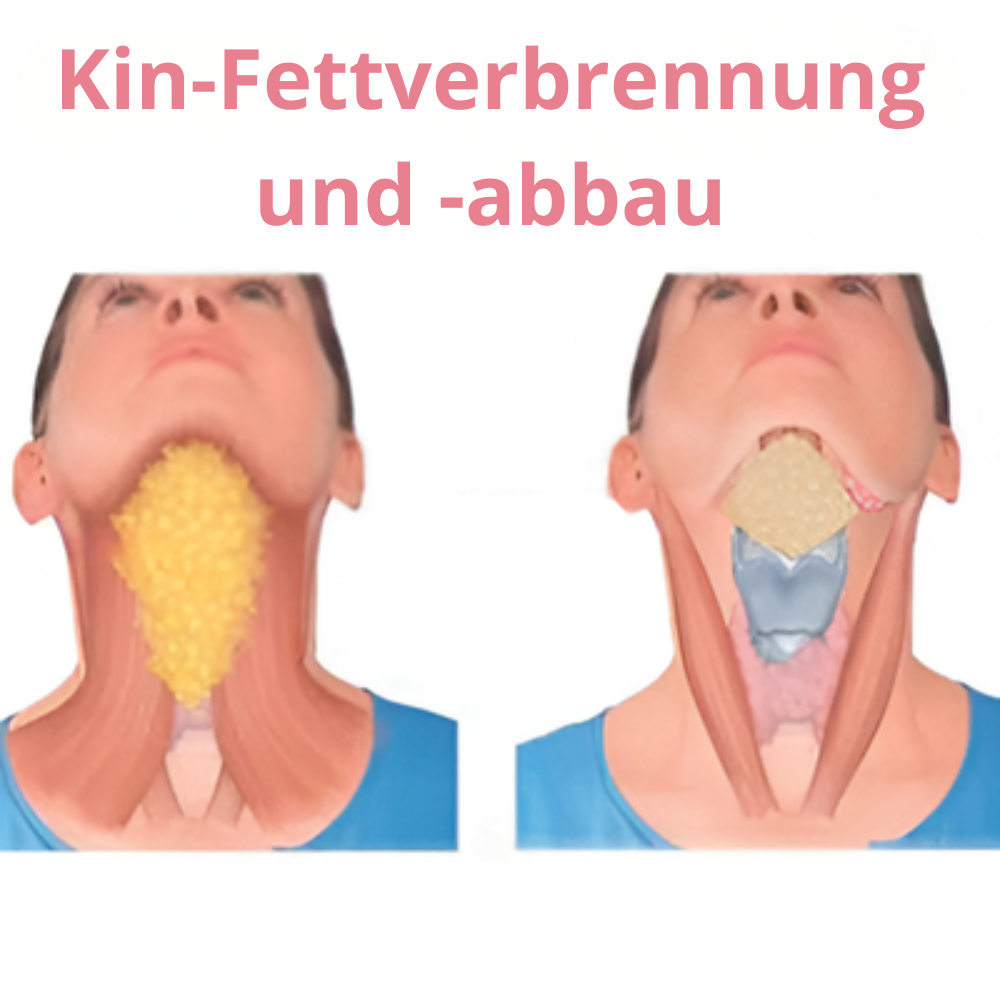 VShape™ – Facial Sculptor, Sag Lebewohl zu deinem lästigen Doppelkinn effektiv [1 + 1 Gratis]