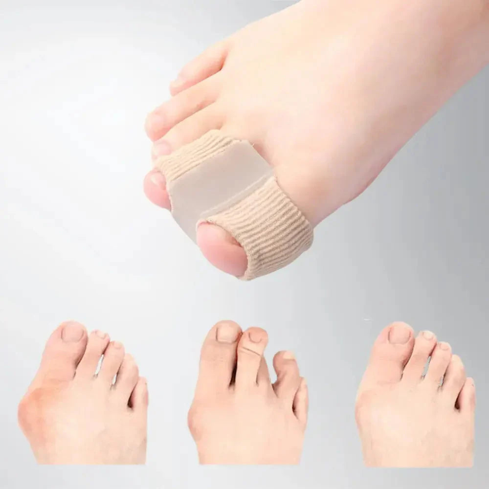 ToeCorrect™ – Sanfte Korrektur von Hallux & überlappenden Zehen [2 + 2 Gratis]