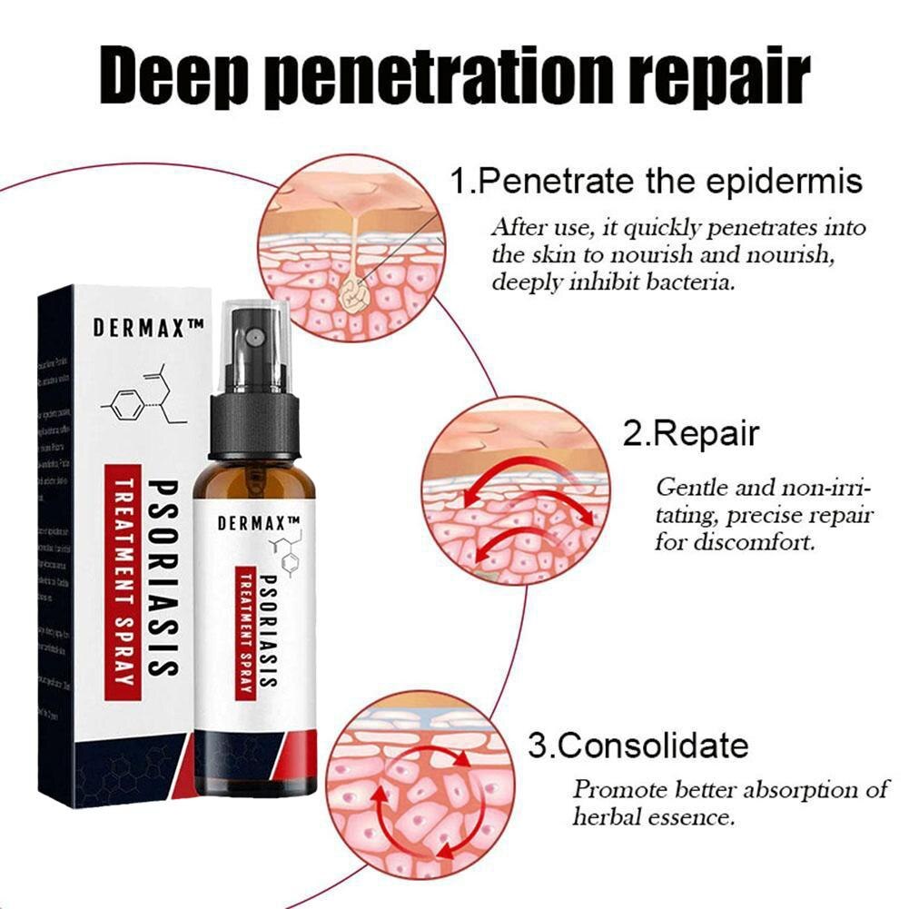 Dermax™ – Effektives Schuppenflechte-Spray für schnelle Hautlinderung [1 + 1 Gratis]