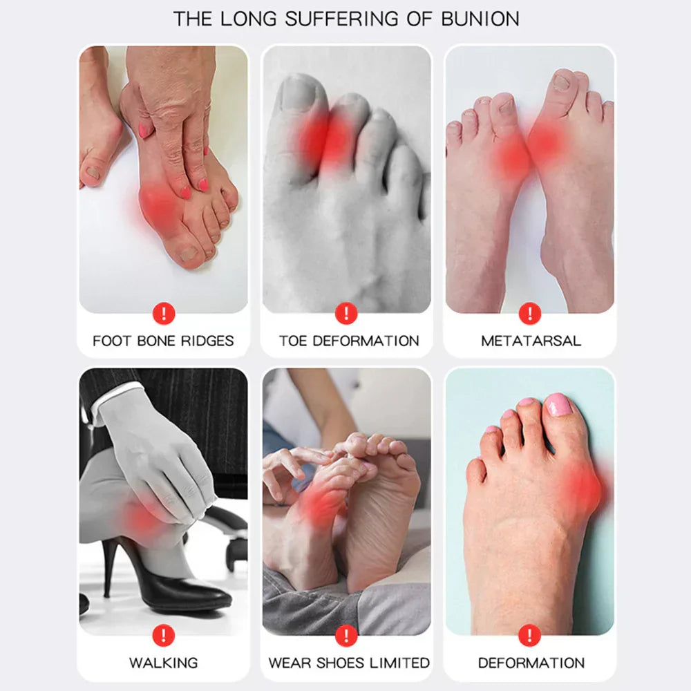 HalluxValgus™ - Ihre komfortable Lösung für schmerzfreie Füße! [1 + 1 Gratis]