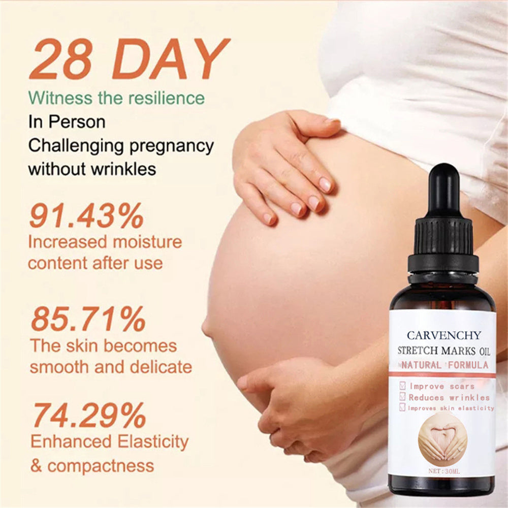 PerfectSkin Dehnungsstreifen-Öl – Natürliche Hautpflege gegen Narben, Striae & trockene Haut