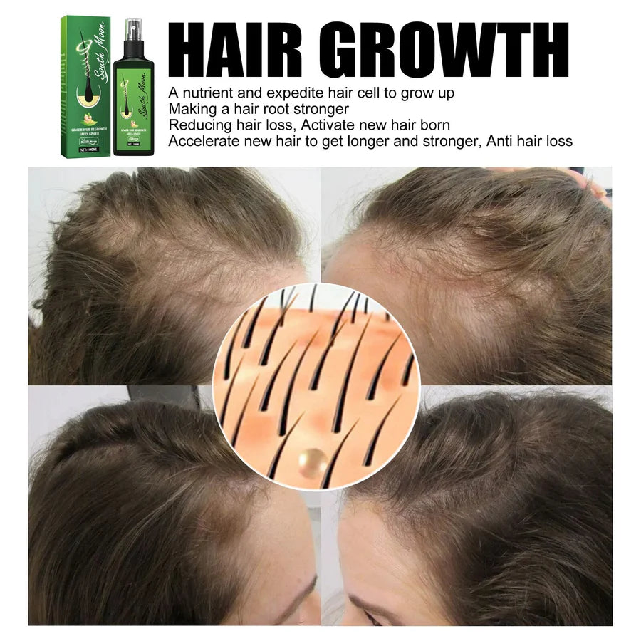 GrowthPlus™ – Nährendes Ingwer-Spray für volleres Haar | NUR HEUTE 1 + 1 GRATIS