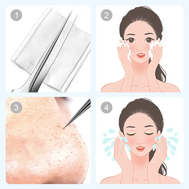 DermaTool Mitesserentferner-Set – Tiefenreinigung, Edelstahl, Hautpflege, Porenreiniger, Sicher