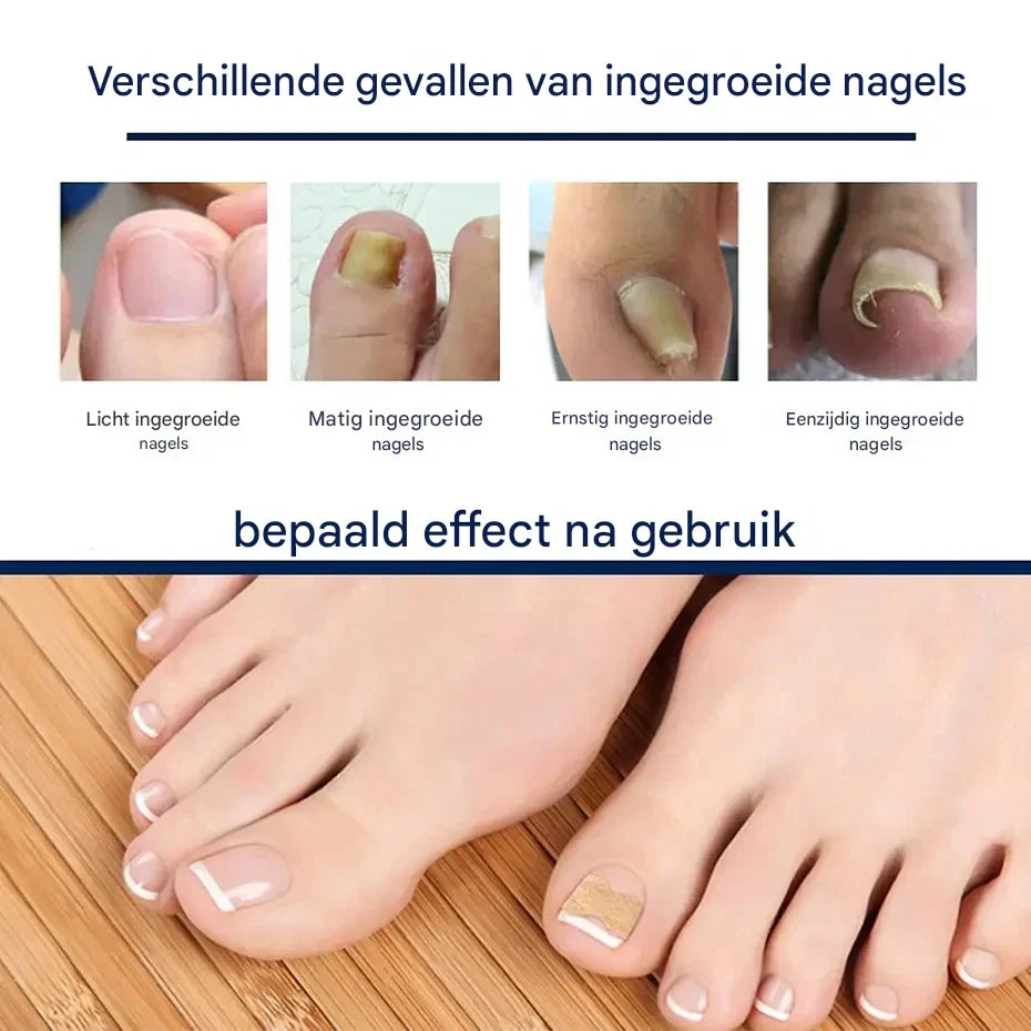 HealthyNail™ – Verschönern Sie Ihre natürlichen Nägel auf sanfte, nachhaltige Weise [25 + 25 Gratis]