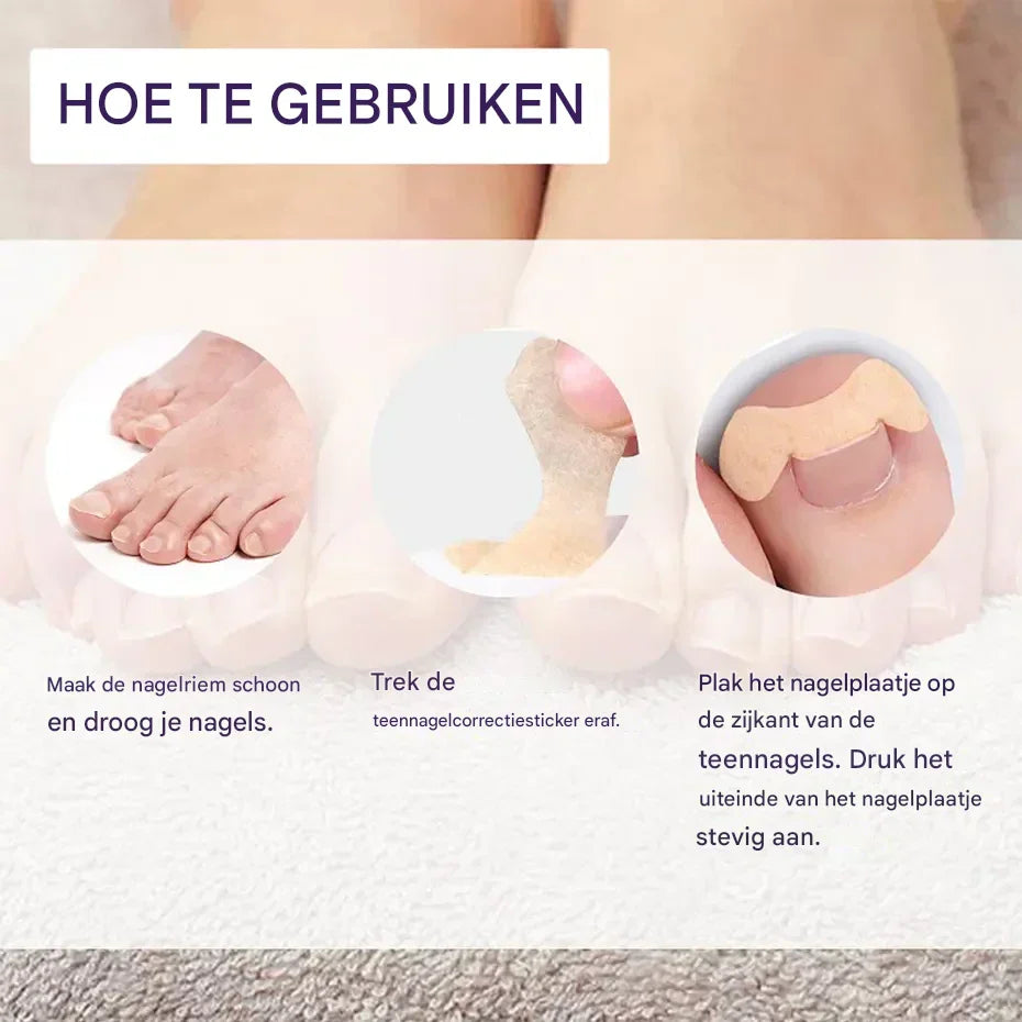 HealthyNail™ – Verschönern Sie Ihre natürlichen Nägel auf sanfte, nachhaltige Weise [25 + 25 Gratis]