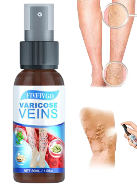 VariCose™ – Effektives Krampfader-Spray für schnelle Linderung und gesunde Beine [1 + 1 Gratis]