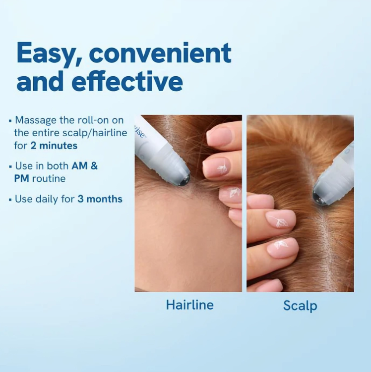 StrandBoost™ – Haarwuchs-Serum-Roller gegen Haarausfall für kräftiges, volles Haar [1 + 1 Gratis]