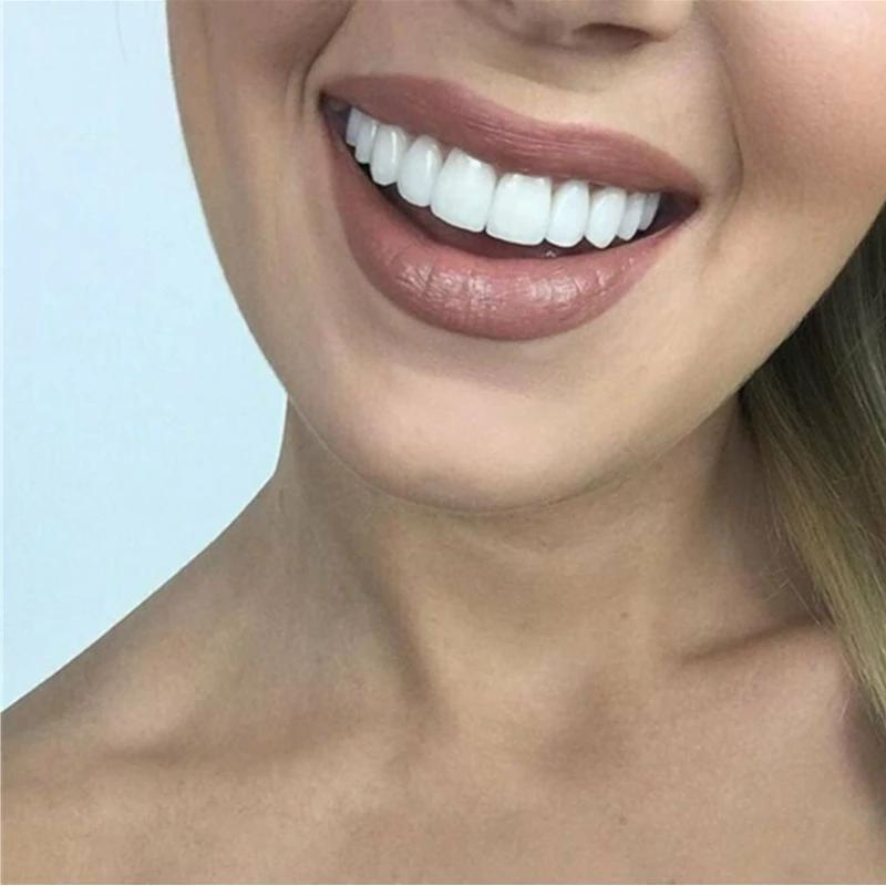 BrightSmile™ - Schnapp-Prothese Für Ein Perfekt Weißes Lächeln [1 + 1 Gratis]