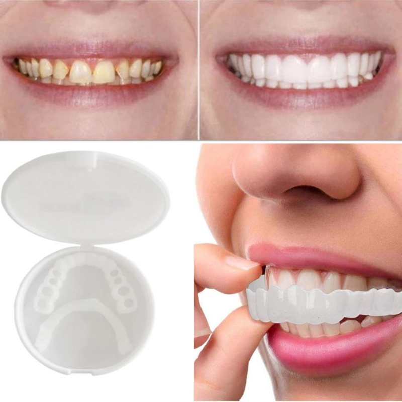 BrightSmile™ - Schnapp-Prothese Für Ein Perfekt Weißes Lächeln [1 + 1 Gratis]