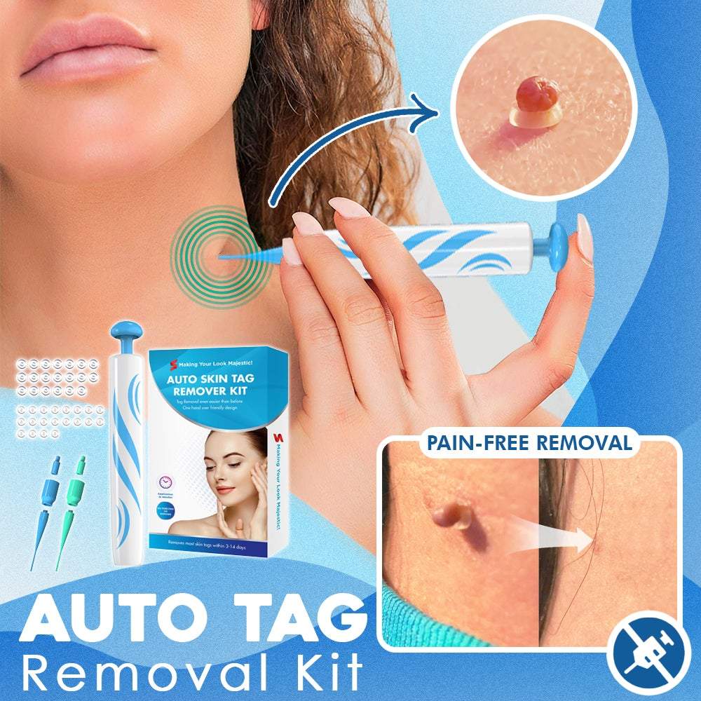 TagRemover™ – Schmerzfreie Entfernung von Hautmarken & Taggen [50 % Rabatt]