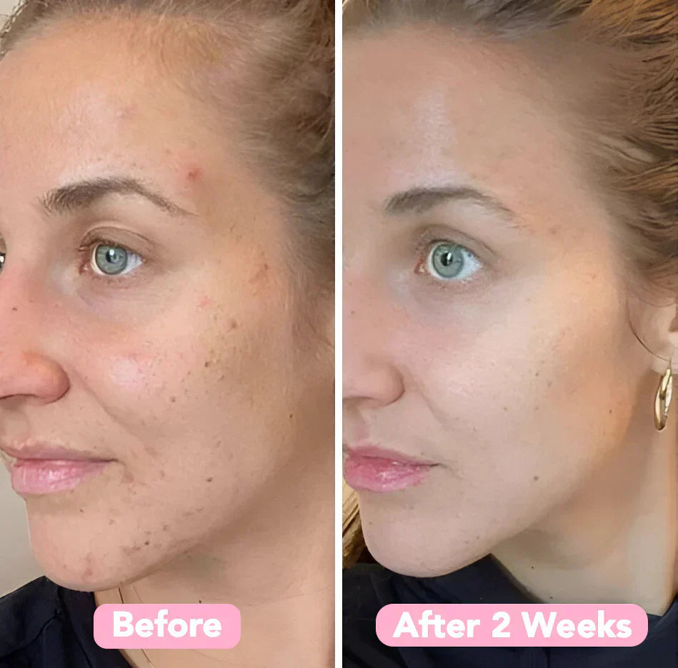 GlowPurify™ – Strahlende Hauterneuerung & tiefenreine Reinigung [50 % Rabatt]